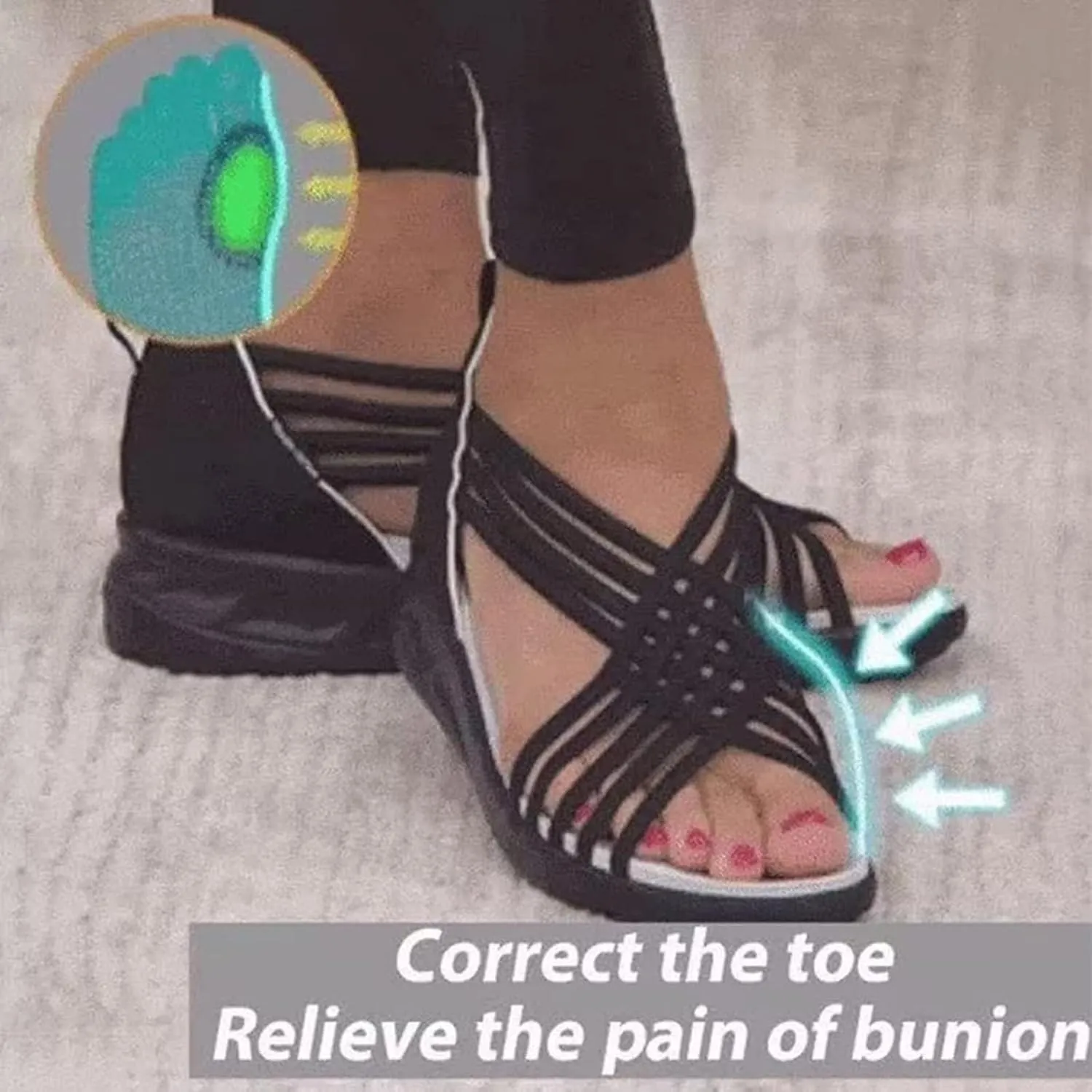 Womens Orthopedic Sandals Summer Arch Support Lightweight Stretch Wedge Heel Cross Straps Slip On Comfy Soft Dressy Outdoor Casual